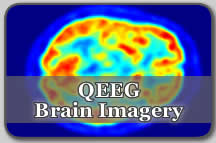 Qeeg Services - qEEG Digital Scans