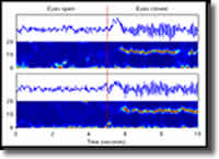 qEEG Scan graph